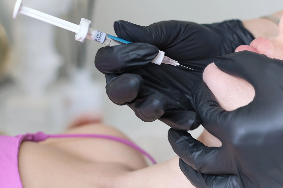 Ozone therapy in aesthetic medicine