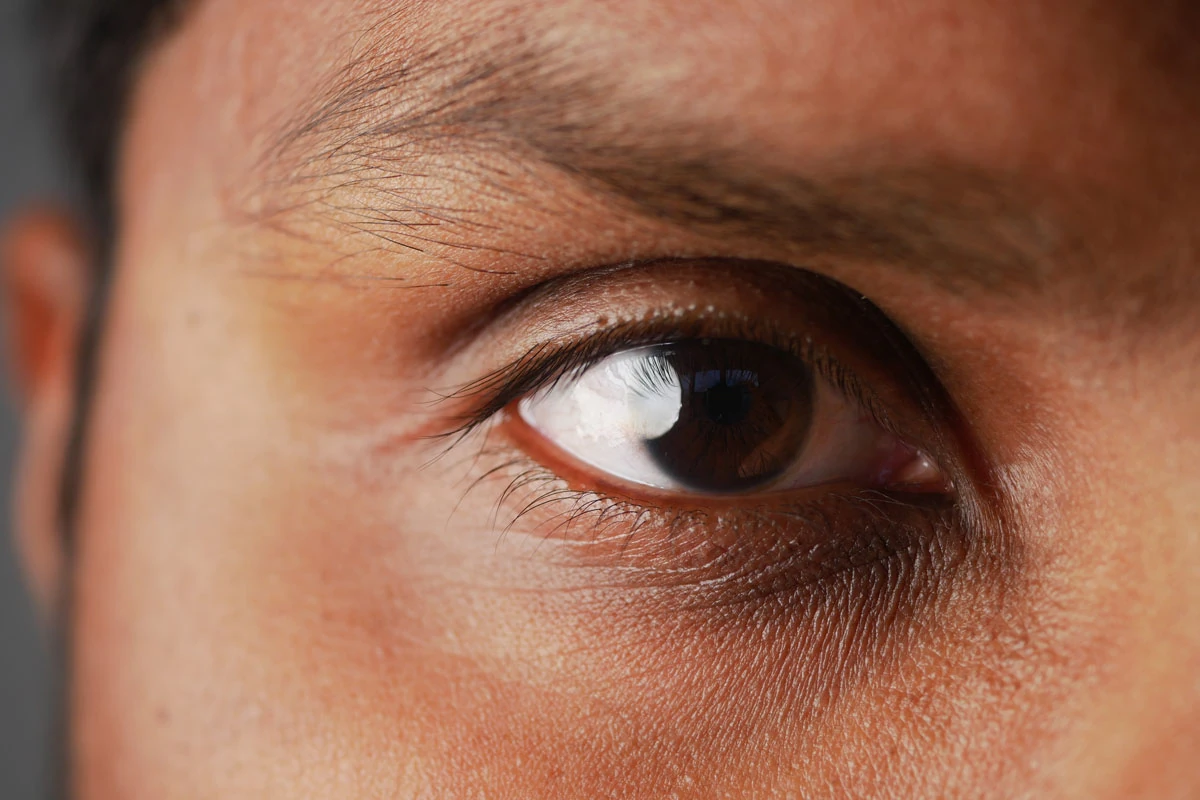 Sport vision — visual skills and athlete reactivity